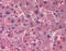AHSG antibody, AP07557PU-N, Origene, Immunohistochemistry paraffin image 