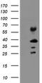 Transmembrane Protein 173 antibody, TA505018BM, Origene, Western Blot image 
