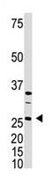 Dickkopf WNT Signaling Pathway Inhibitor 4 antibody, AP11557PU-N, Origene, Western Blot image 