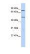 Zinc finger protein 252 antibody, NBP1-91519, Novus Biologicals, Western Blot image 