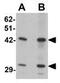 SEC62 Homolog, Preprotein Translocation Factor antibody, GTX31455, GeneTex, Western Blot image 