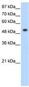 Small Nuclear Ribonucleoprotein U1 Subunit 70 antibody, TA345724, Origene, Western Blot image 