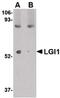 Leucine Rich Glioma Inactivated 1 antibody, PA5-20506, Invitrogen Antibodies, Western Blot image 