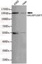 HAUSP antibody, TA347070, Origene, Western Blot image 