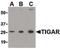 TP53 Induced Glycolysis Regulatory Phosphatase antibody, PA5-20347, Invitrogen Antibodies, Western Blot image 