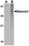 Nanos C2HC-Type Zinc Finger 1 antibody, PA5-20556, Invitrogen Antibodies, Western Blot image 