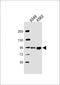 Rho GTPase Activating Protein 27 antibody, 56-480, ProSci, Western Blot image 