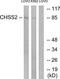 Chondroitin Polymerizing Factor antibody, TA315791, Origene, Western Blot image 