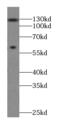 FANCD2 And FANCI Associated Nuclease 1 antibody, FNab05409, FineTest, Western Blot image 