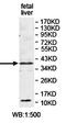 ELMO Domain Containing 2 antibody, orb78260, Biorbyt, Western Blot image 