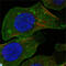 Discoidin Domain Receptor Tyrosine Kinase 2 antibody, LS-C812565, Lifespan Biosciences, Immunofluorescence image 