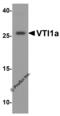 Vesicle Transport Through Interaction With T-SNAREs 1A antibody, 8287, ProSci, Western Blot image 