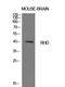 Rh Blood Group D Antigen antibody, A01082, Boster Biological Technology, Western Blot image 