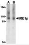 Serine/threonine-protein kinase/endoribonuclease IRE1 antibody, 3659, ProSci Inc, Western Blot image 
