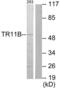 TNF Receptor Superfamily Member 11b antibody, LS-C118651, Lifespan Biosciences, Western Blot image 