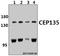 Centrosomal Protein 135 antibody, A06361-1, Boster Biological Technology, Western Blot image 