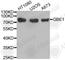 GLGB antibody, A3296, ABclonal Technology, Western Blot image 