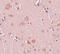 Pleckstrin Homology And RUN Domain Containing M2 antibody, 5485, ProSci Inc, Immunohistochemistry frozen image 