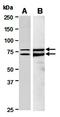 Caspase 12 (Gene/Pseudogene) antibody, orb67170, Biorbyt, Western Blot image 