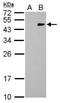 RFP antibody, NBP2-43713, Novus Biologicals, Western Blot image 
