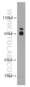 Coiled-coil domain-containing protein 120 antibody, 22041-1-AP, Proteintech Group, Western Blot image 