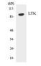 Leukocyte Receptor Tyrosine Kinase antibody, EKC1704, Boster Biological Technology, Western Blot image 