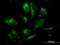 Glutathione S-transferase Mu 2 antibody, H00002946-M03, Novus Biologicals, Immunofluorescence image 