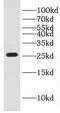 Growth Hormone Inducible Transmembrane Protein antibody, FNab03450, FineTest, Western Blot image 