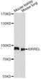 Kirre Like Nephrin Family Adhesion Molecule 1 antibody, LS-C749287, Lifespan Biosciences, Western Blot image 