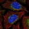 WASH Complex Subunit 2A antibody, HPA060975, Atlas Antibodies, Immunocytochemistry image 