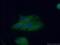 15-Hydroxyprostaglandin Dehydrogenase antibody, 11035-1-AP, Proteintech Group, Immunofluorescence image 