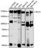 Proline, Glutamate And Leucine Rich Protein 1 antibody, A3189, ABclonal Technology, Western Blot image 