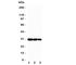 CRAF1 antibody, R31115, NSJ Bioreagents, Western Blot image 