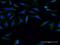 Formin-1 antibody, H00342184-M07, Novus Biologicals, Immunofluorescence image 