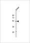 Rubicon Like Autophagy Enhancer antibody, 62-093, ProSci, Western Blot image 