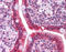 MAC2 antibody, ARP54688_P050, Aviva Systems Biology, Immunohistochemistry paraffin image 