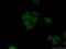 PLAG1 Zinc Finger antibody, 18018-1-AP, Proteintech Group, Immunofluorescence image 