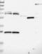 Zinc Finger And BTB Domain Containing 26 antibody, NBP1-80591, Novus Biologicals, Western Blot image 