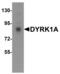 Dual Specificity Tyrosine Phosphorylation Regulated Kinase 1A antibody, NBP1-76559, Novus Biologicals, Western Blot image 