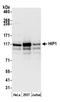 Huntingtin-interacting protein 1 antibody, A305-175A, Bethyl Labs, Western Blot image 