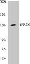 iNOS antibody, EKC1302, Boster Biological Technology, Western Blot image 