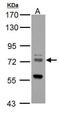 Zinc Finger DHHC-Type Containing 17 antibody, GTX114192, GeneTex, Western Blot image 