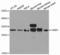 Histamine N-Methyltransferase antibody, A13499, ABclonal Technology, Western Blot image 