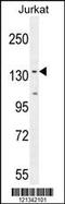 Protein Phosphatase 1 Regulatory Subunit 3A antibody, TA324365, Origene, Western Blot image 