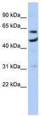 CCR4-NOT Transcription Complex Subunit 6 antibody, TA343830, Origene, Western Blot image 