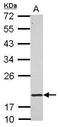 Ring Finger Protein 5 antibody, GTX121006, GeneTex, Western Blot image 