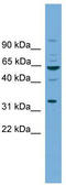 Wnt Family Member 8B antibody, TA344461, Origene, Western Blot image 