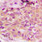 Mitogen-Activated Protein Kinase Kinase Kinase 5 antibody, LS-C358801, Lifespan Biosciences, Immunohistochemistry paraffin image 