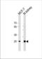 Carbonic anhydrase 2 antibody, TA324917, Origene, Western Blot image 