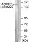FA Complementation Group D2 antibody, PA5-38114, Invitrogen Antibodies, Western Blot image 